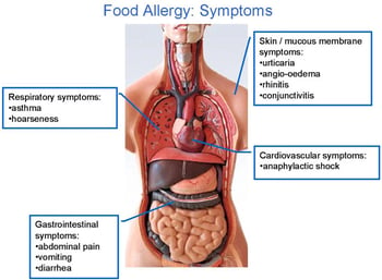 Symptoms-of-food-allergy.jpg